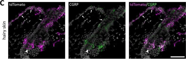 Fig.5.C showing Immunohistochemistry-immunofluorescence in a Mus musculus (House mouse) sample from the publication: A NaV1.8FlpO mouse enabling selective intersectional targeting of low threshold C fiber mechanoreceptors and nociceptors.