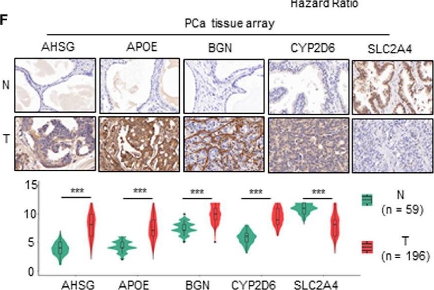 Fig.4.F showing Immunohistochemistry from the publication: A Metabolism-Related Gene Landscape Predicts Prostate Cancer Recurrence and Treatment Response.