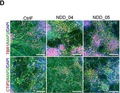 Fig.1.D showing Immunocytochemistry-immunofluorescence in a Homo sapiens (Human) sample from the publication: Characterization of a loss-of-function NSF attachment protein beta mutation in monozygotic triplets affected with epilepsy and autism using cortical neurons from proband-derived and CRISPR-corrected induced pluripotent stem cell lines.