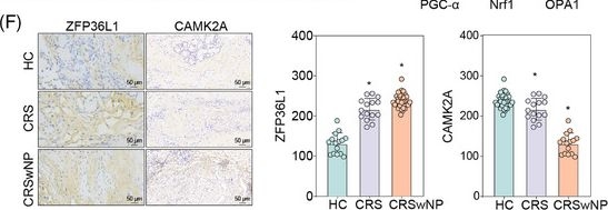Fig.8.F showing Immunohistochemistry in a Homo sapiens (Human) sample from the publication: RNA binding protein ZFP36L1 promotes ferroptosis in chronic rhinosinusitis by destabilizing CAMK2A mRNA and impairing mitochondrial quality control.