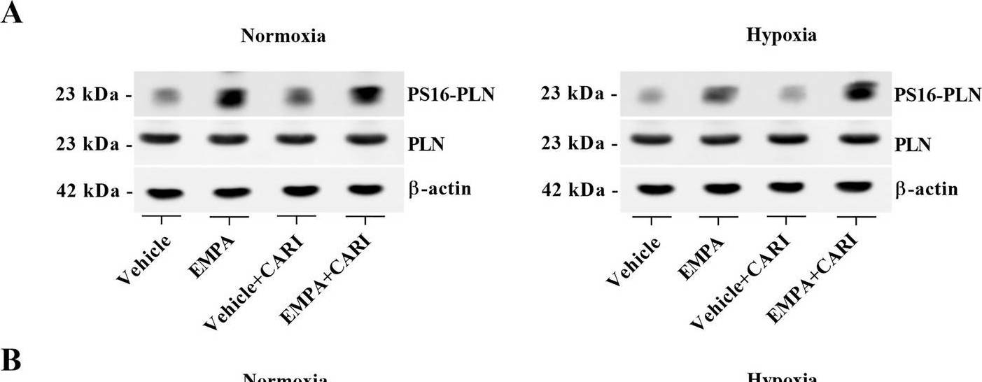 Fig.8.A showing Western Blotting in a Rattus norvegicus (Rat) sample from the publication: Empagliflozin reduces arrhythmogenic effects in rat neonatal and human iPSC-derived cardiomyocytes and improves cytosolic calcium handling at least partially independent of NHE1.