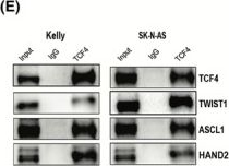 Fig.1.E showing Western Blotting in a Homo sapiens (Human) sample from the publication: Transcription factor 4 is a key mediator of oncogenesis in neuroblastoma by promoting MYC activity.