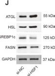 Fig.8.J showing Western Blotting in a Mus musculus (House mouse) sample from the publication: HSF1 modulates lipid metabolism and ferroptosis in sarcopenia: a novel diagnostic biomarker and therapeutic target.