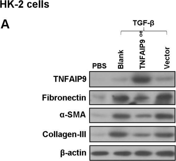 Fig.7.A showing Western Blotting in a Mus musculus (House mouse) sample from the publication: TNFAIP9 protects against the development of the early stage of chronic kidney disease: Focus on inflammation and fibrosis.