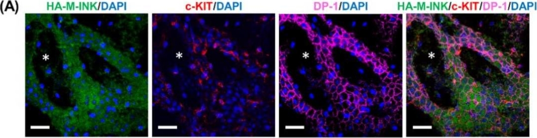 A Novel Method for Visualizing Melanosome and Melanin Distribution in Human Skin Tissues.