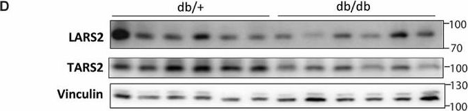 Fig.4.D showing Western Blotting from the publication: Decreased expression of mitochondrial aminoacyl-tRNA synthetases causes downregulation of OXPHOS subunits in type 2 diabetic muscle.