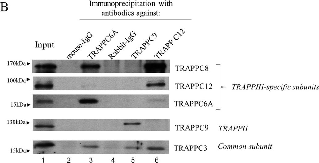 Fig.1.B showing Immunoprecipitation in a Homo sapiens (Human) sample from the publication: Mammalian TRAPPIII Complex positively modulates the recruitment of Sec13/31 onto COPII vesicles.
