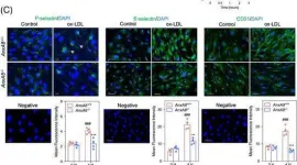 Fig.7.C showing Immunocytochemistry-immunofluorescence from the publication: Annexin A8 deficiency delays atherosclerosis progression.