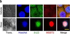 Fig.9.B showing Immunocytochemistry-immunofluorescence in a Homo sapiens (Human) sample from the publication: Leukotriene C4 is the major trigger of stress-induced oxidative DNA damage.