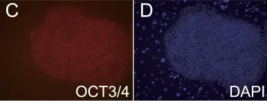 Fig.2.C showing Immunohistochemistry-immunofluorescence in a Homo sapiens (Human) sample from the publication: Expression of mutant mRNA and protein in pancreatic cells derived from MODY3- iPS cells.