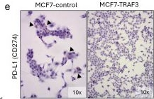 Fig.5.E showing Immunohistochemistry in a Homo sapiens (Human) sample from the publication: Dual Role of Cancer Epithelial-Specific TRAF3 in Regulating Breast Cancer Cell Survival and Lymphocyte Activity.