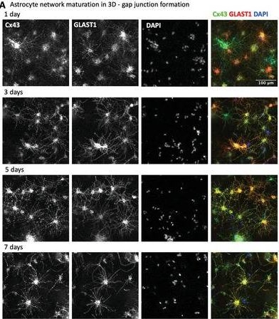 Fig.3.A showing Immunohistochemistry in a Rattus norvegicus (Rat) sample from the publication: Electrophysiological In Vitro Study of Long-Range Signal Transmission by Astrocytic Networks.