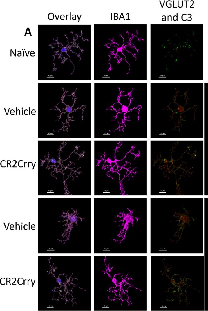 Fig.4.A showing Immunocytochemistry-immunofluorescence in a Mus musculus (House mouse) sample from the publication: Complement propagates visual system pathology following traumatic brain injury.