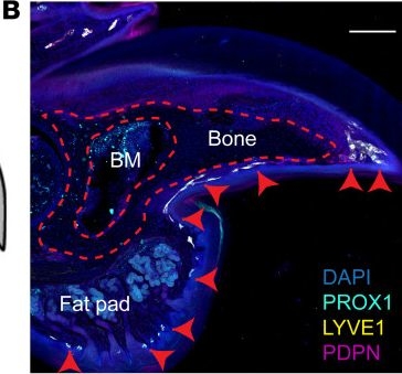 Fig.1.B showing Immunohistochemistry-immunofluorescence in a Mus musculus (House mouse) sample from the publication: Targeting lymphatic vessels enhances bone regeneration by augmenting osteoclast activity in mouse models of amputation.