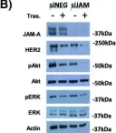 Fig.1.B showing Western Blotting from the publication: Cleavage of the extracellular domain of junctional adhesion molecule-A is associated with resistance to anti-HER2 therapies in breast cancer settings.