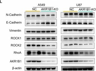 Fig.7.L showing Western Blotting from the publication: AKR1B1-dependent fructose metabolism enhances malignancy of cancer cells.