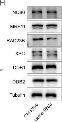 Fig.2.H showing Western Blotting from the publication: Lamins regulate cancer cell plasticity and chemosensitivity.