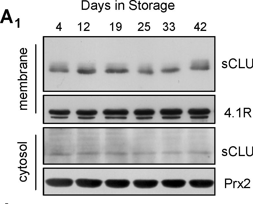 Fig.2.A showing Western Blotting in a Homo sapiens (Human) sample from the publication: Apolipoprotein J/clusterin in human erythrocytes is involved in the molecular process of defected material disposal during vesiculation.