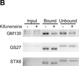 Fig.6.B showing Western Blotting in a Homo sapiens (Human) sample from the publication: Golgi self-correction generates bioequivalent glycans to preserve cellular homeostasis.