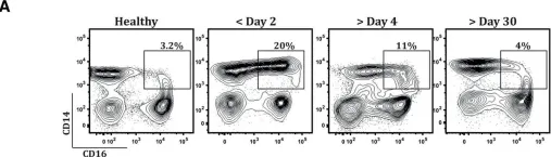 Fig.6.A showing Flow cytometry/Cell sorting from the publication: Immune Response to Dengue Virus Infection in Pediatric Patients in New Delhi, India--Association of Viremia, Inflammatory Mediators and Monocytes with Disease Severity.