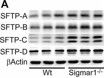 Fig.7.A showing Western Blotting in a Mus musculus (House mouse) sample from the publication: Sigmar1 ablation leads to lung pathological changes associated with pulmonary fibrosis, inflammation, and altered surfactant proteins levels.