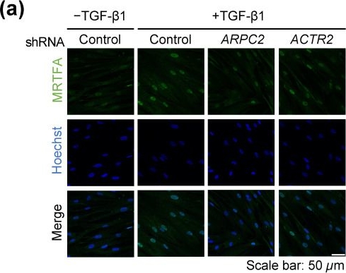 Fig.3.A showing Immunocytochemistry-immunofluorescence from the publication: ARPC2 Promotes Pulmonary Fibrosis by Regulating MRTFA Activity Independent of the Canonical ARP2/3 Complex.
