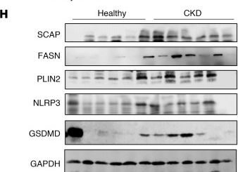 Fig.7.H showing Western Blotting from the publication: ACSS2 gene variants determine kidney disease risk by controlling de novo lipogenesis in kidney tubules.