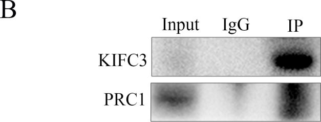 Fig.5.B showing Western Blotting in a Mus musculus (House mouse) sample from the publication: Kinesin KIFC3 is essential for microtubule stability and cytokinesis in oocyte meiosis.