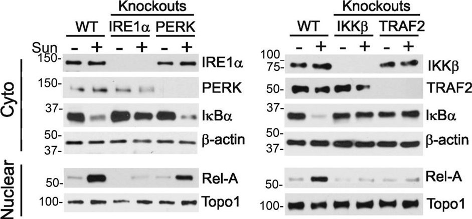 Fig.3.A showing Western Blotting in a Homo sapiens (Human) sample from the publication: The convergent roles of NF-κB and ER stress in sunitinib-mediated expression of pro-tumorigenic cytokines and refractory phenotype in renal cell carcinoma.
