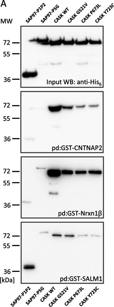 Fig.9.A showing Western Blotting from the publication: Patient-Derived Variants Define Constraints for Ligand Binding at the PDZ Domain of CASK.