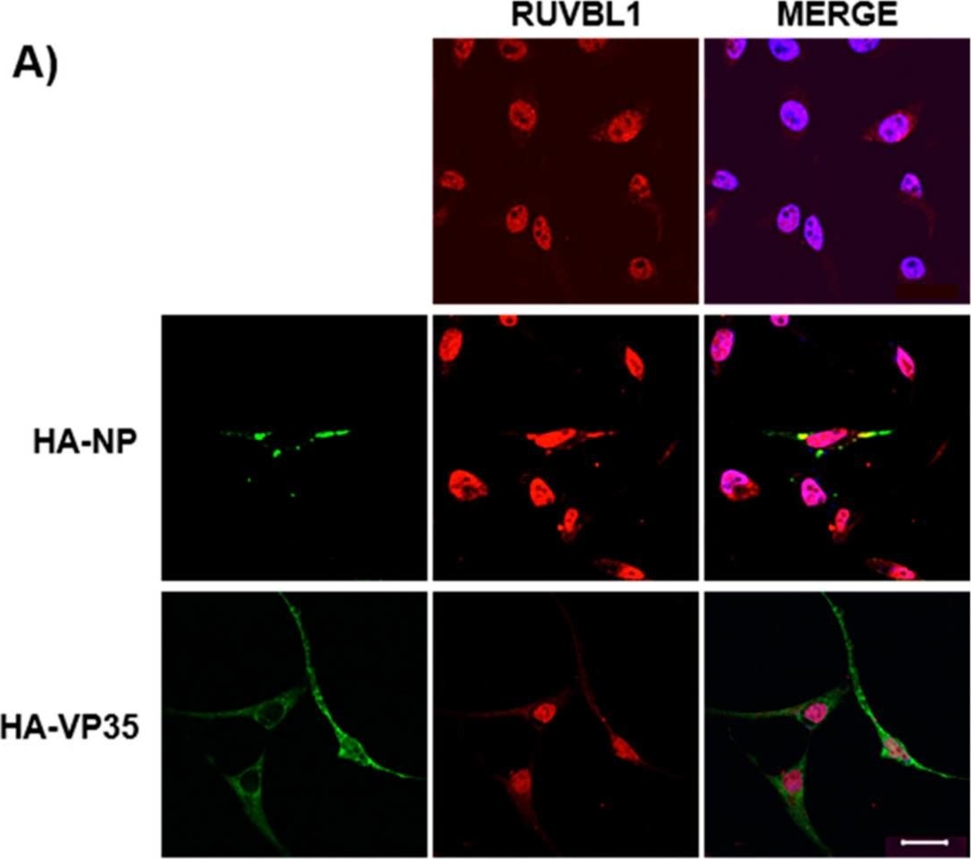 Fig.3.A showing Immunocytochemistry-immunofluorescence in a Homo sapiens (Human) sample from the publication: Identification of RUVBL1 and RUVBL2 as Novel Cellular Interactors of the Ebola Virus Nucleoprotein.