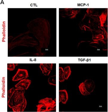 Fig.1.A from the publication: Role of MCP-1 and IL-8 in viral anterior uveitis, and contractility and fibrogenic activity of trabecular meshwork cells.