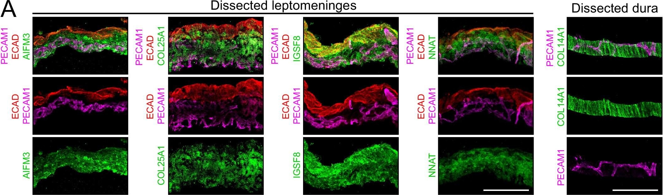 Fig.3.A showing Immunohistochemistry-immunofluorescence from the publication: Bacterial meningitis in the early postnatal mouse studied at single-cell resolution.