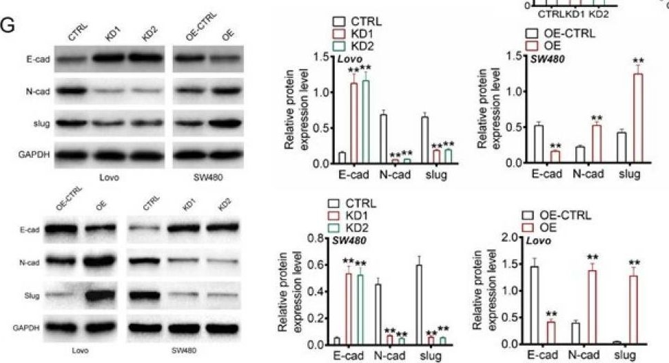Fig.3.G showing Western Blotting in a Homo sapiens (Human) sample from the publication: Hsa_circ_0000467 promotes colorectal cancer proliferation and stem cell characteristics by activating the TCF4/Wnt/β-catenin pathway via sponging miR-520g.