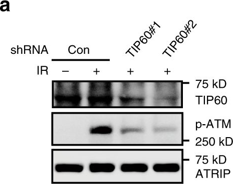 Fig.1.A showing Western Blotting in an Oryctolagus cuniculus (Rabbit) sample from the publication: Acetylation of XPF by TIP60 facilitates XPF-ERCC1 complex assembly and activation.
