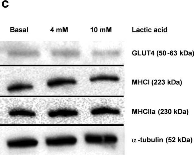 Fig.6.C showing Western Blotting in a Homo sapiens (Human) sample from the publication: Utilization of lactic acid in human myotubes and interplay with glucose and fatty acid metabolism.