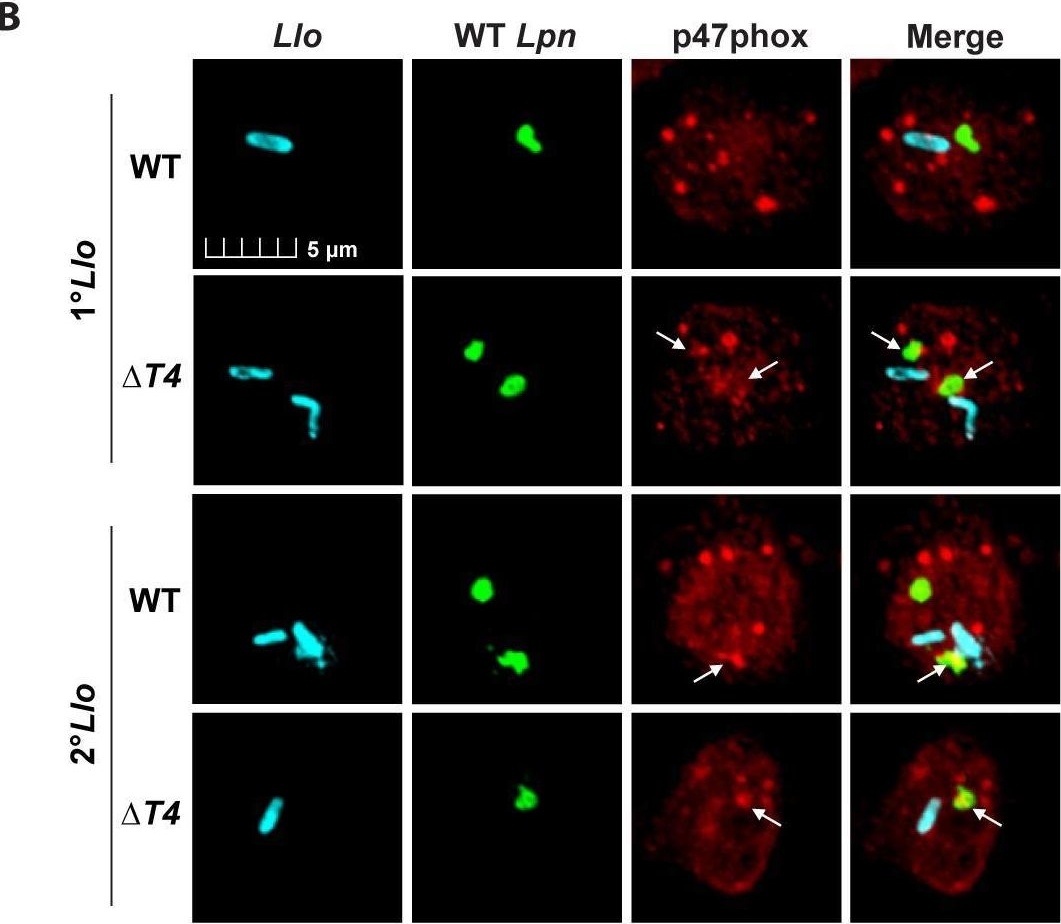 Fig.6.B showing Immunocytochemistry-immunofluorescence from the publication: Inhibition and evasion of neutrophil microbicidal responses by Legionella longbeachae.