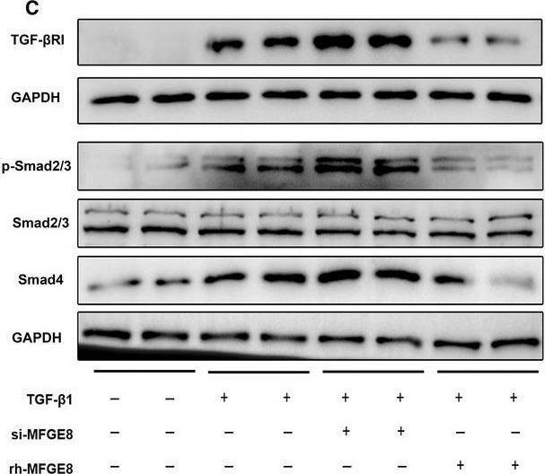 Fig.7.C showing Western Blotting in a Homo sapiens (Human) sample from the publication: MFGE8 is down-regulated in cardiac fibrosis and attenuates endothelial-mesenchymal transition through Smad2/3-Snail signalling pathway.