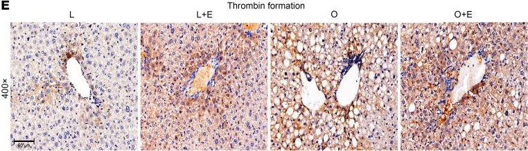 Fig.3.E showing Immunohistochemistry in a Mus musculus (House mouse) sample from the publication: Estrogen and obesity synergistically suppress protein S via HIF1α, enhancing thrombosis potential.