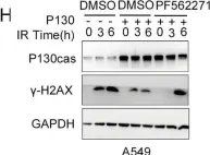 Fig.4.H showing Western Blotting from the publication: P130cas-FAK interaction is essential for YAP-mediated radioresistance of non-small cell lung cancer.