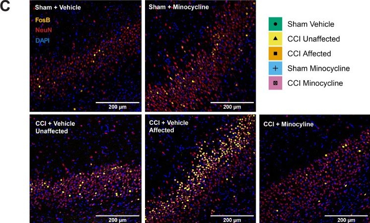 Fig.5.C showing Immunohistochemistry-immunofluorescence from the publication: Minocycline Abrogates Individual Differences in Nerve Injury-Evoked Affective Disturbances in Male Rats and Prevents Associated Supraspinal Neuroinflammation.