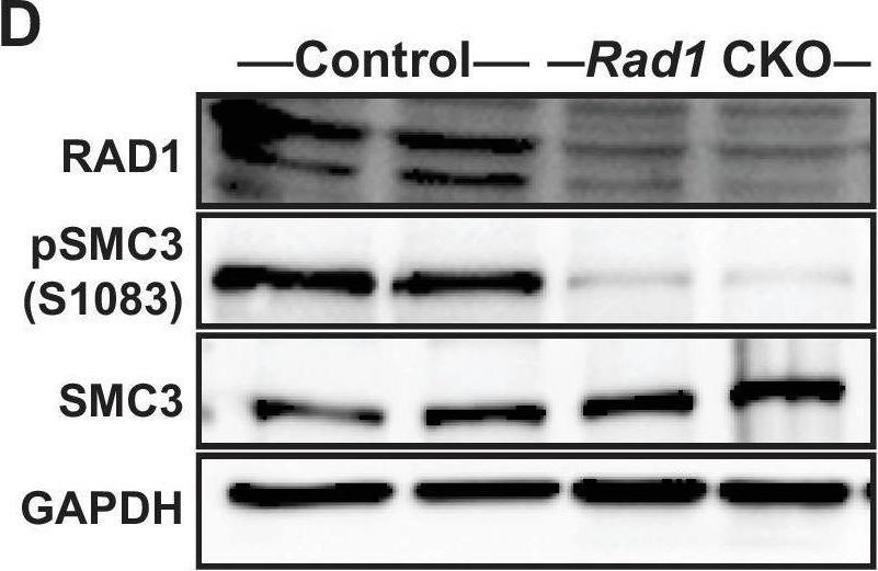 Fig.5.D showing Western Blotting in a Mus musculus (House mouse) sample from the publication: Multiple 9-1-1 complexes promote homolog synapsis, DSB repair, and ATR signaling during mammalian meiosis.