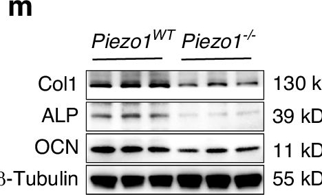 Fig.1.M showing Western Blotting from the publication: Mechanism of Piezo1 regulating chondrocyte mitochondrial function and promoting fracture healing through β-catenin/LARS2 signaling pathway.
