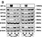 Fig.5.B showing Western Blotting from the publication: A HIF-1α inhibitor combined with palmitic acid and L-carnitine treatment can prevent the fat metabolic reprogramming under hypoxia and induce apoptosis in hepatocellular carcinoma cells.