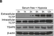 Fig.2.B showing Western Blotting in a Homo sapiens (Human) sample from the publication: Extracellular translationally controlled tumor protein promotes colorectal cancer invasion and metastasis through Cdc42/JNK/ MMP9 signaling.