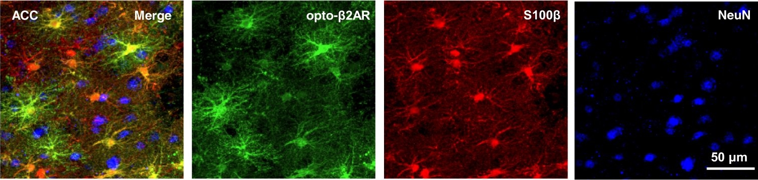 Fig.5.A showing Immunohistochemistry-immunofluorescence in a Rattus norvegicus (Rat) sample from the publication: Adrenergic signalling to astrocytes in anterior cingulate cortex contributes to pain-related aversive memory in rats.