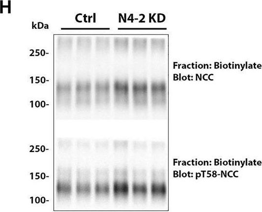 Fig.3.H showing Western Blotting in a Mus musculus (House mouse) sample from the publication: The E3 ubiquitin-protein ligase Nedd4-2 regulates the sodium chloride cotransporter NCC but is not required for a potassium-induced reduction of NCC expression.