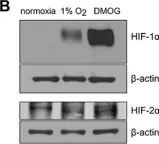 Fig.2.B showing Western Blotting in a Mus musculus (House mouse) sample from the publication: Hypoxia favors myosin heavy chain beta gene expression in an Hif-1alpha-dependent manner.