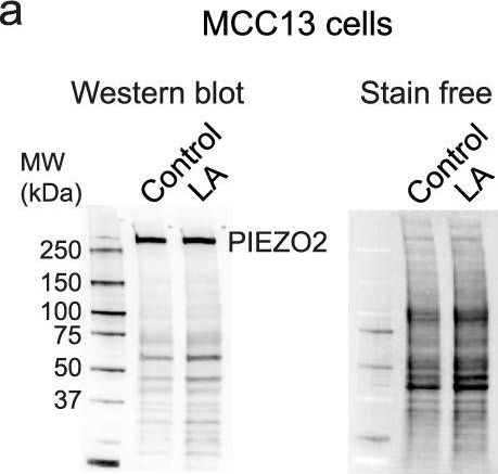 Fig.5.A showing Western Blotting in a Homo sapiens (Human) sample from the publication: Linoleic acid improves PIEZO2 dysfunction in a mouse model of Angelman Syndrome.
