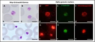 Fig.4.A showing Immunocytochemistry-immunofluorescence in a Homo sapiens (Human) sample from the publication: A Novel GATA1 Variant in the C-Terminal Zinc Finger Compared with the Platelet Phenotype of Patients with A Likely Pathogenic Variant in the N-Terminal Zinc Finger.